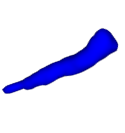 Optic Nerve