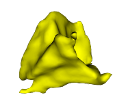 Intraconal Fat